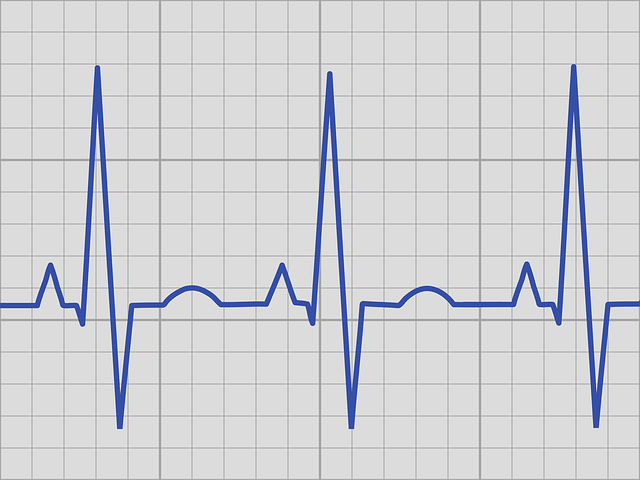 ekg